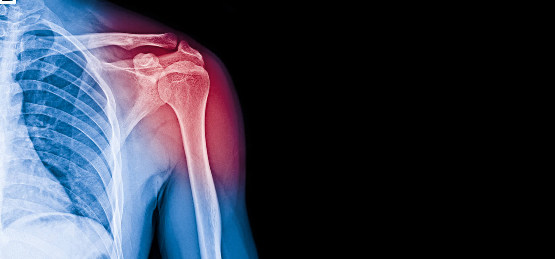 banner-shoulder Hand & wrist surgeon in Shortlands
